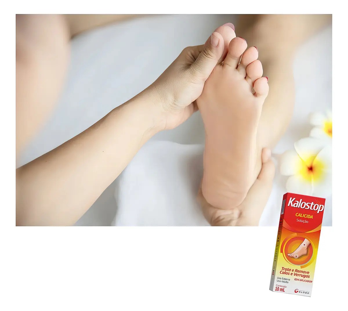 Kalostop Calicida Solucao 10 mL Globo